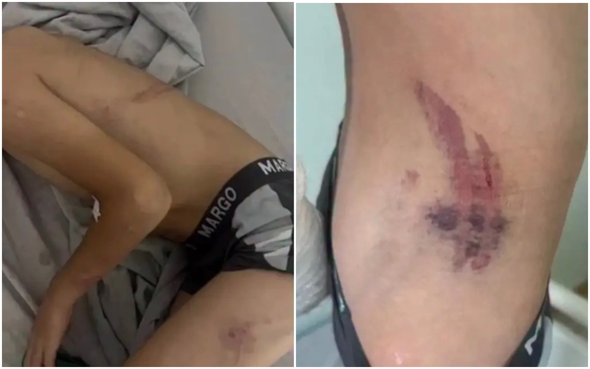 “Қазақмыс” қызметкері 8 жасар баланы соққыға жыққан