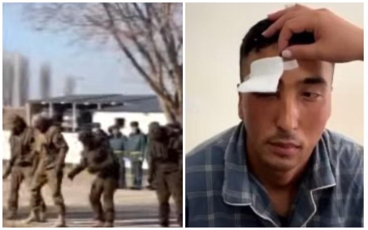 Жамбыл облысында сарбаз ант қабылдау кезінде көз жанарынан айырылды